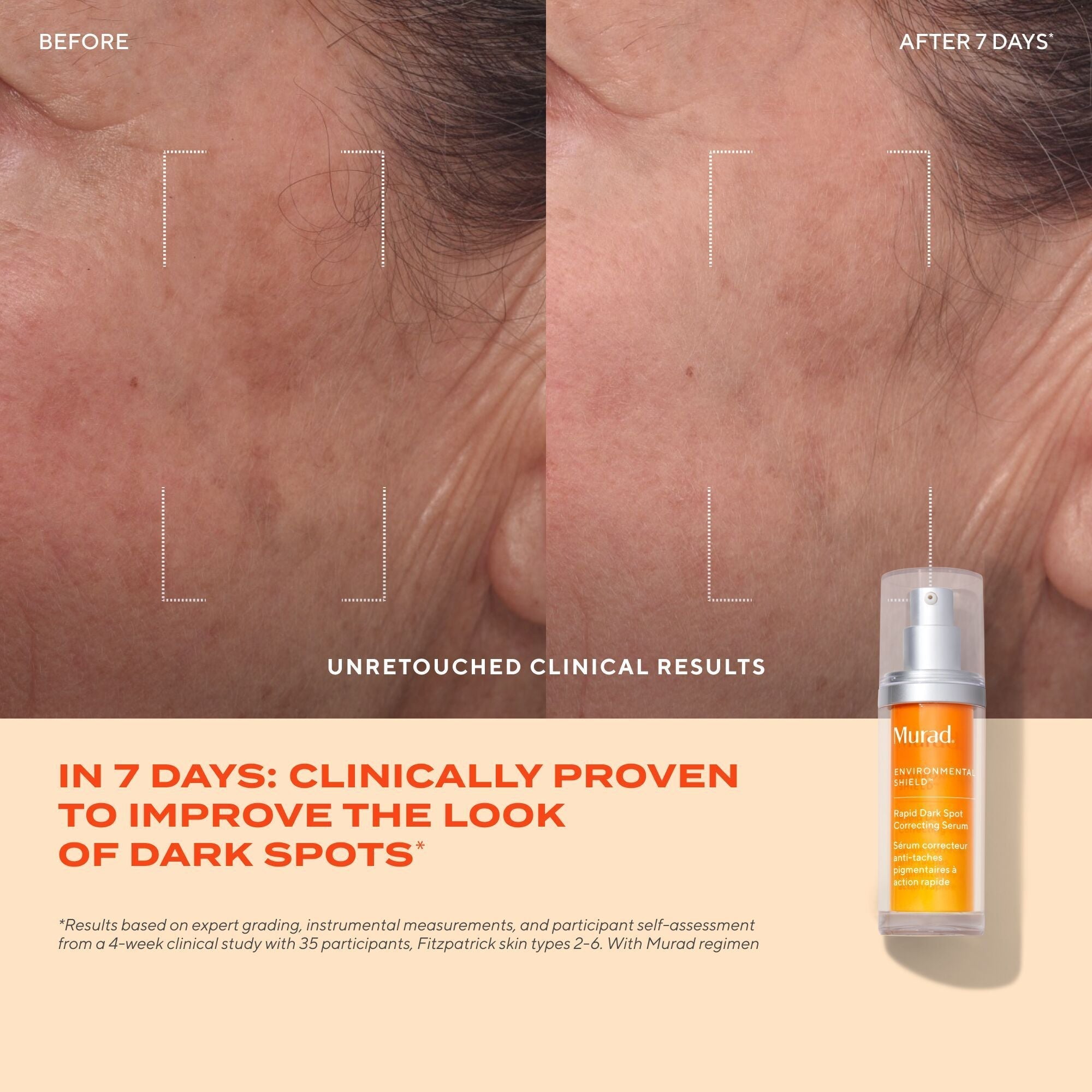 Murad Rapid Dark Spot Correcting Serum, 30ml