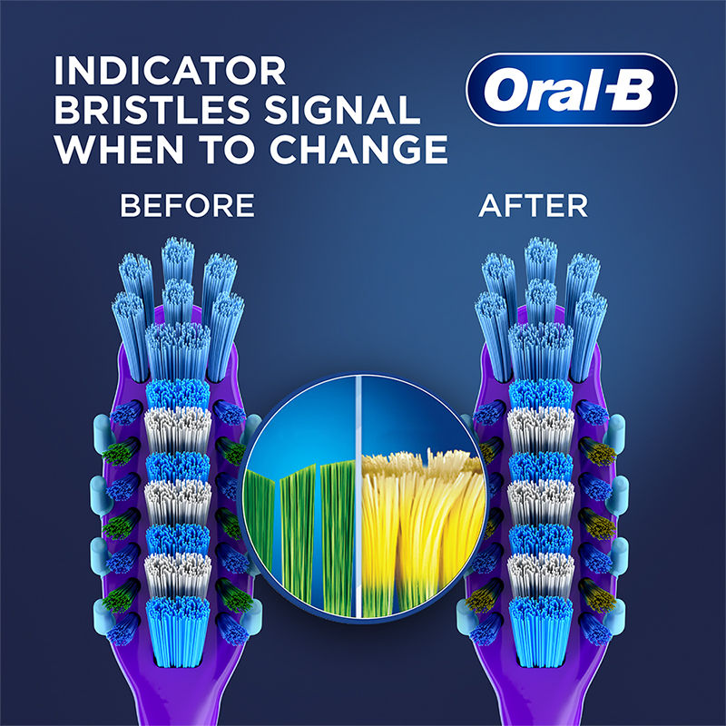 Oral-B Criss Cross Gum Care Toothbrush (Buy 2 Get 2 Free, Soft) Buy at Indicrest Image 6