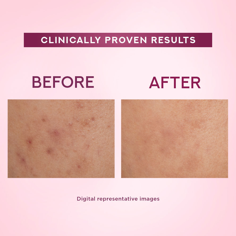 Pond’s Bright Beauty Anti-Spot Serum Cream with Niacinamide and SPF 15 PA++, Fades Dark Spots, 50g Buy at Indicrest Image 4