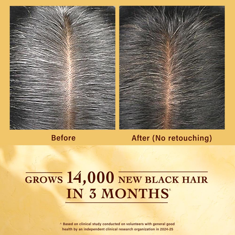 Indulekha Jatamansi Premature Greying Treatment Scalp Serum, 30ml Buy at Indicrest Image 3